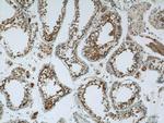 CCDC105 Antibody in Immunohistochemistry (Paraffin) (IHC (P))