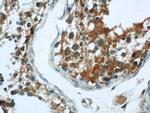 CCDC105 Antibody in Immunohistochemistry (Paraffin) (IHC (P))
