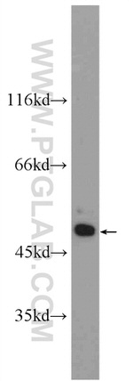 CCDC105 Antibody in Western Blot (WB)