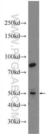 CCDC105 Antibody in Western Blot (WB)