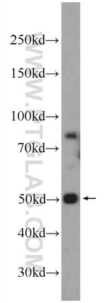 CCDC105 Antibody in Western Blot (WB)