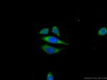 ANKRD39 Antibody in Immunocytochemistry (ICC/IF)