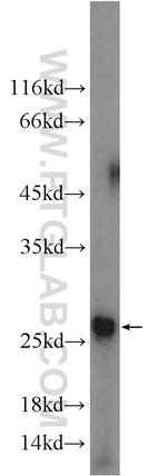 ANKRD39 Antibody in Western Blot (WB)