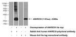 ANKRD39 Antibody in Western Blot (WB)