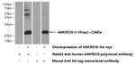 ANKRD39 Antibody in Western Blot (WB)