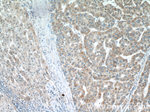 CMC1 Antibody in Immunohistochemistry (Paraffin) (IHC (P))