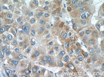 CMC1 Antibody in Immunohistochemistry (Paraffin) (IHC (P))