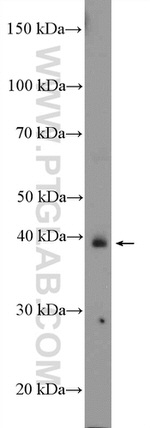 ASB5 Antibody in Western Blot (WB)