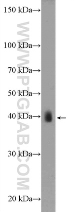 ASB5 Antibody in Western Blot (WB)