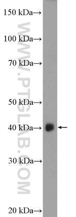 ASB5 Antibody in Western Blot (WB)