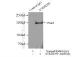 ANKRD50 Antibody in Immunoprecipitation (IP)