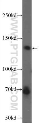 ANKRD50 Antibody in Western Blot (WB)