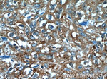 ANKRD57 Antibody in Immunohistochemistry (Paraffin) (IHC (P))