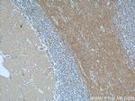 ANKRD57 Antibody in Immunohistochemistry (Paraffin) (IHC (P))