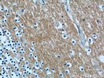 ANKRD57 Antibody in Immunohistochemistry (Paraffin) (IHC (P))