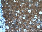 ANKRD27 Antibody in Immunohistochemistry (Paraffin) (IHC (P))