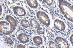 ANKRD22 Antibody in Immunohistochemistry (Paraffin) (IHC (P))