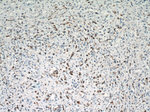 PCNA Antibody in Immunohistochemistry (Paraffin) (IHC (P))