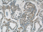 ZDHHC9 Antibody in Immunohistochemistry (Paraffin) (IHC (P))