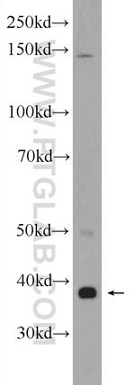 ZDHHC9 Antibody in Western Blot (WB)