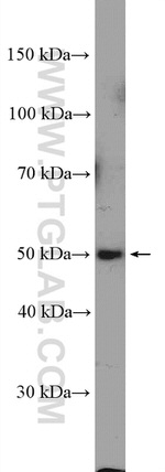 ZDHHC9 Antibody in Western Blot (WB)