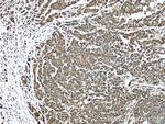 KRT23 Antibody in Immunohistochemistry (Paraffin) (IHC (P))