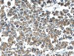KRT23 Antibody in Immunohistochemistry (Paraffin) (IHC (P))