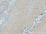 KRT23 Antibody in Immunohistochemistry (Paraffin) (IHC (P))