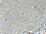 KRT23 Antibody in Immunohistochemistry (Paraffin) (IHC (P))