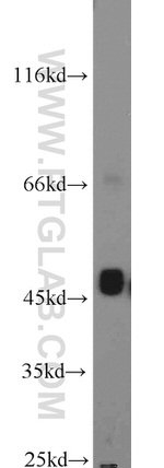 KRT23 Antibody in Western Blot (WB)