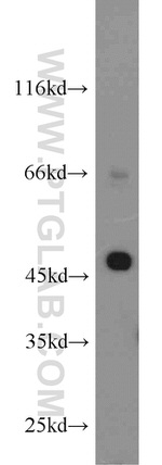 KRT23 Antibody in Western Blot (WB)