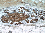 ANKS3 Antibody in Immunohistochemistry (Paraffin) (IHC (P))
