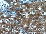 ANKS3 Antibody in Immunohistochemistry (Paraffin) (IHC (P))