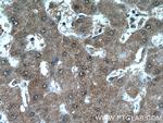ANKS3 Antibody in Immunohistochemistry (Paraffin) (IHC (P))