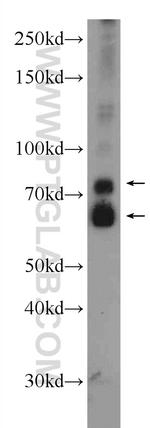ANKS3 Antibody in Western Blot (WB)