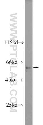 ANKS3 Antibody in Western Blot (WB)