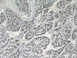 SGF29 Antibody in Immunohistochemistry (Paraffin) (IHC (P))