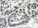 SGF29 Antibody in Immunohistochemistry (Paraffin) (IHC (P))