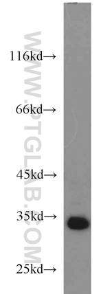 SGF29 Antibody in Western Blot (WB)