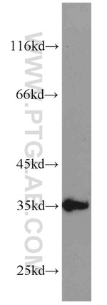 SGF29 Antibody in Western Blot (WB)