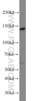 Matrilin 2 Antibody in Western Blot (WB)