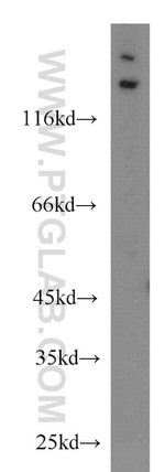 Matrilin 2 Antibody in Western Blot (WB)