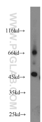 SLC36A4 Antibody in Western Blot (WB)