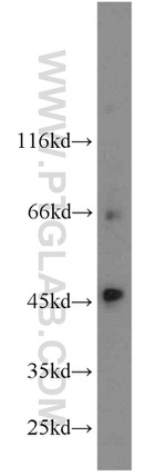 SLC36A4 Antibody in Western Blot (WB)