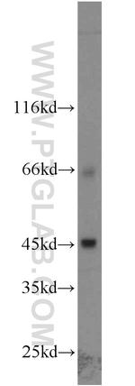 SLC36A4 Antibody in Western Blot (WB)