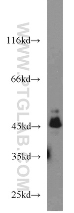 C9orf41 Antibody in Western Blot (WB)