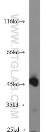 C9orf41 Antibody in Western Blot (WB)