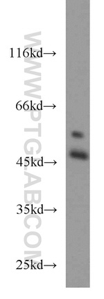 C9orf41 Antibody in Western Blot (WB)