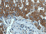 ITIH4 Antibody in Immunohistochemistry (Paraffin) (IHC (P))