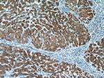 ITIH4 Antibody in Immunohistochemistry (Paraffin) (IHC (P))